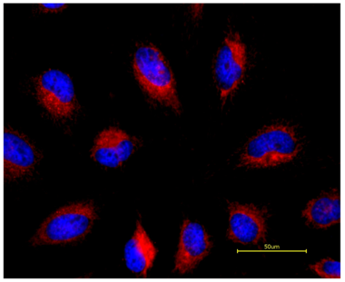 HeLa細胞におけるGGR169-セラミドゴルジ染色