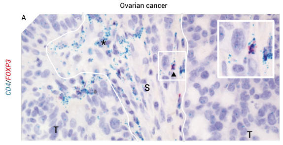 feature-regulatory-t-cell_02.jpg