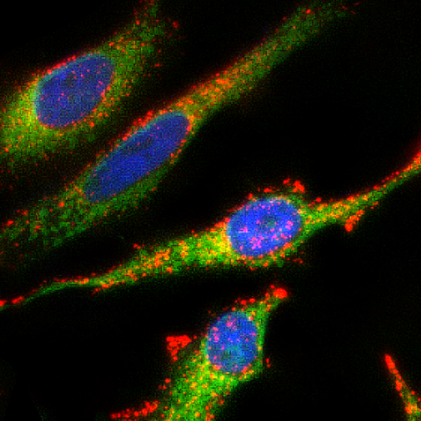 organelles_fluorescence_probe_abd_02.png