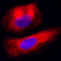 organelles_fluorescence_probe_abd_06.png