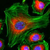 organelles_fluorescence_probe_abd_11.jpg