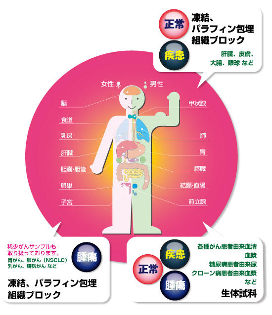 Tissue Solutions 社:ヒト組織・生体試料 供給受託