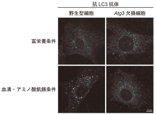 LC3_antibody_icc_cac_3.jpg