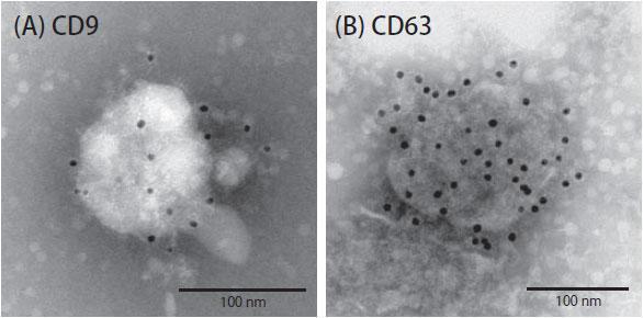 免疫電子顕微鏡によるタンパク質検出例 