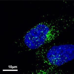 Immunostaining with anti-CD36 antibody