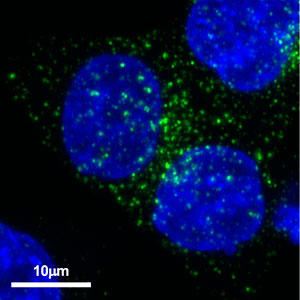 Immunostaining with anti-CD36 antibody