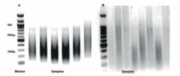 PVS_ChIP_assay_tips_1.jpg