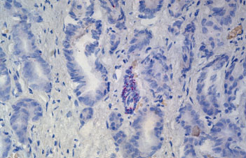 ヒト前立腺 FFPE 切片の TP63 mRNA の検出（赤色）