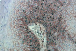 MULTIVIEW(R) PLUS IHC Kits