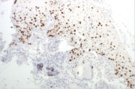 Ki-67 Monoclonal Antibody