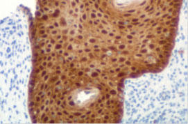 p16INK4a mAb Antibody