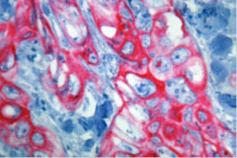 HIGHDEF(R) Red IHC Chromogen (AP)