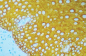 HIGHDEF(R) Yellow IHC Chromogen (HRP)