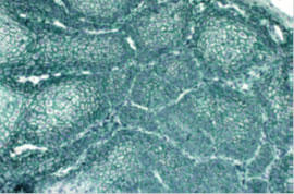 HIGHDEF(R) Green IHC Chromogen (AP)