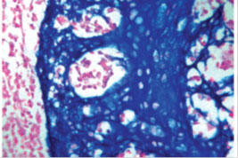 HIGHDEF(R) Blue IHC Chromogen (HRP)